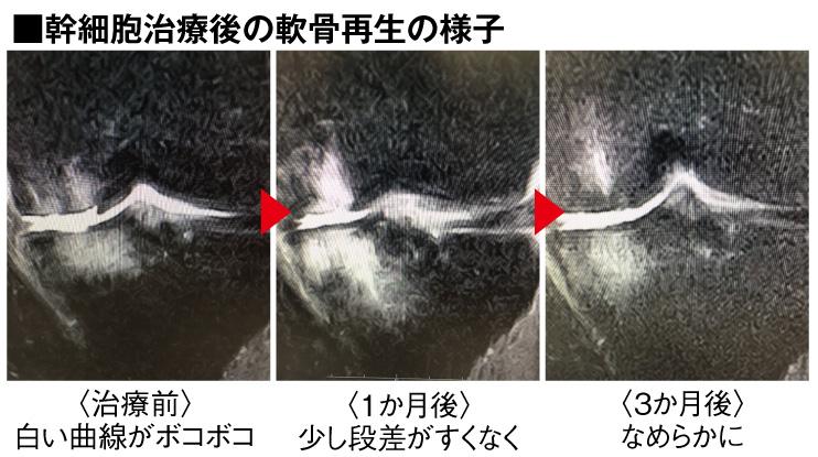 関節の再生医療 リソークリニック